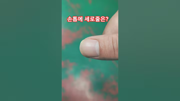 손톱의 세로줄은 무엇 때문 일까요? #건강정보
