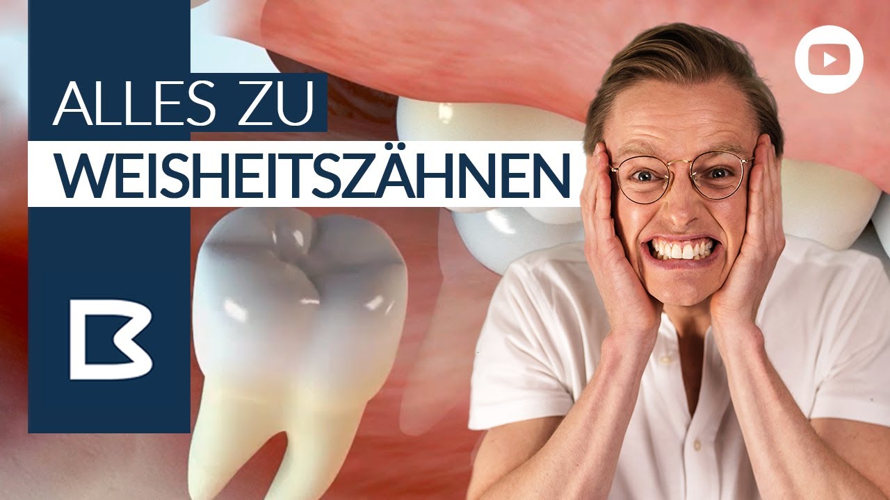 Wann Schwillt Wange Nach Weisheitszahn Op Ab WEISHEITSZÄHNE: ALLES was Ihr wissen müsst! Wie, WANN, WARUM? Inkl. 3D