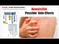 Amoxicillin  possible  side effect of amoxicillin  amoxicillin antibiotic overdose side effects