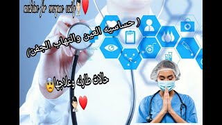 حالات  طارئة  وعلاجها حلقه رقم 1 ( حساسيه العين والتهاب الجفن) ❤??‍⚕ medicine for everyone easily