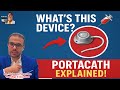 Portacath: The Secret Device Behind Easier Chemo! | ProHealthConsults