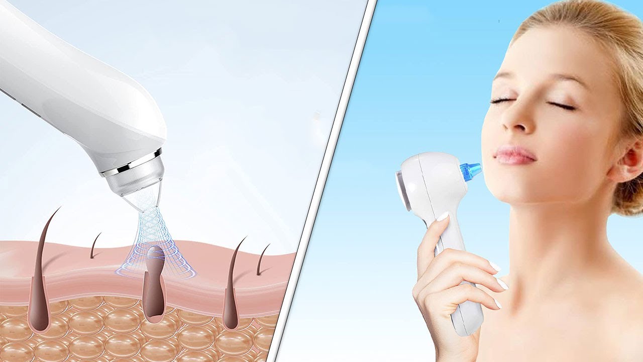 Achieve Clear Skin with the Best Blackhead Pore Vacuum Remover