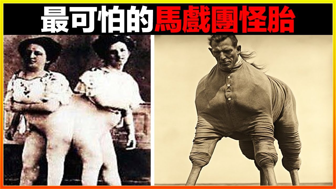 奇怪男子長有兩個生x器？無數女士爭相圍觀。18個最不可思議的馬戲團怪胎，猶如外星人來到地球｜#世界之最top #世界之最 #冷知識 #腦洞大開 #top10  #地球之最 #排名