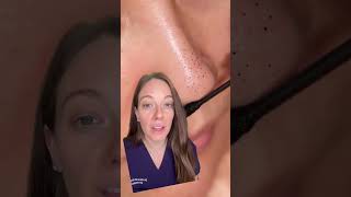Blackheads! How to Banish Those Pesky Nose Spots 👃