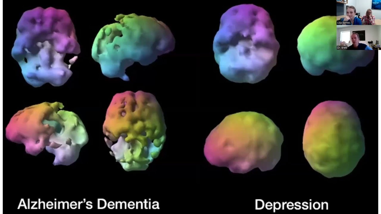 Why you need AXIO with Dr Brett Brimhall