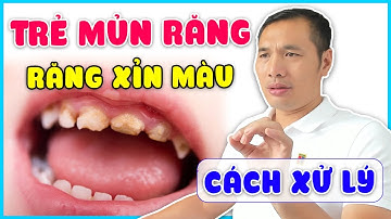Trẻ bị SÂU RĂNG, MỦN RĂNG, RĂNG XỈN MÀU - Xử lí như thế nào cho chuẩn?| Dược sĩ Trương Minh Đạt