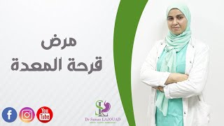 مرض قرحة المعدة