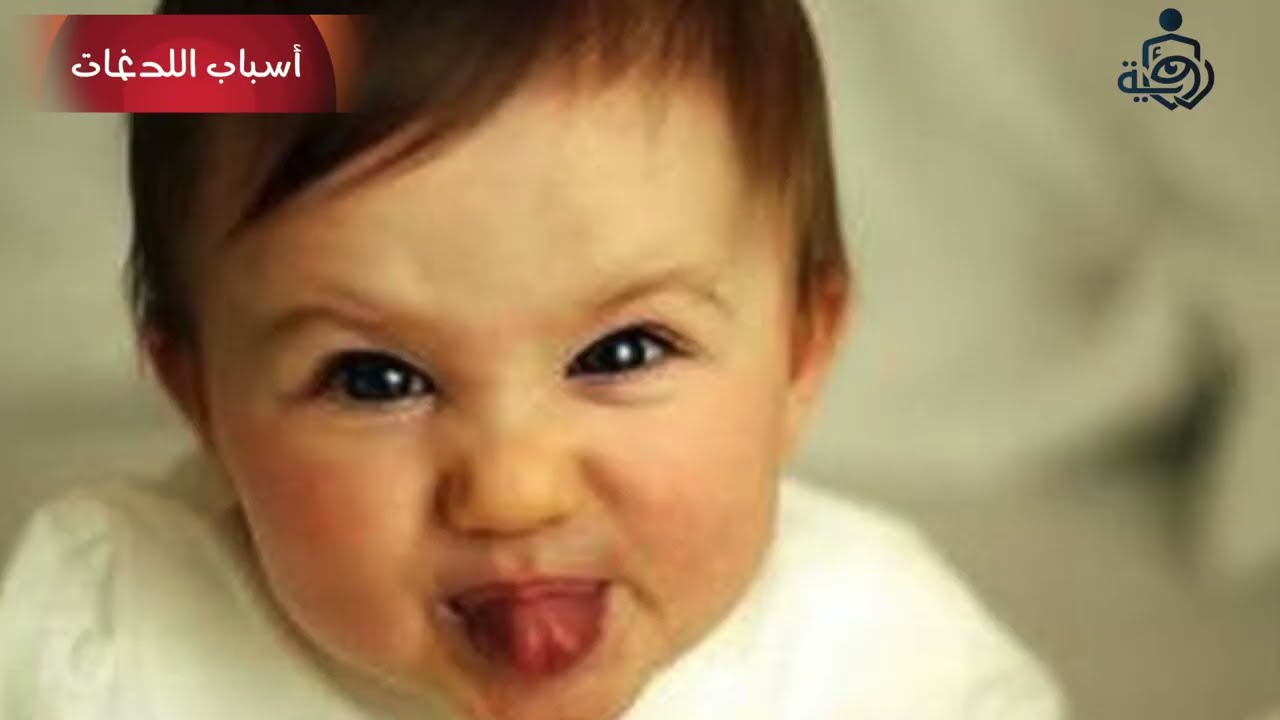 أسباب اللدغات