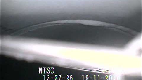 Foreign Object Retrieval