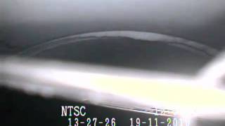 Foreign Object Retrieval