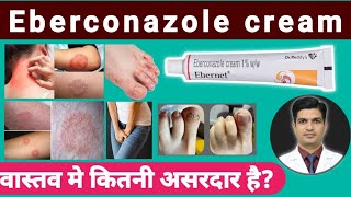 दद, खज, खजल क दमदर करम Eberconazole Cream Uses In Hindi