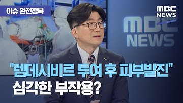 [이슈 완전정복] "렘데시비르 투여 후 피부발진" 심각한 부작용?…"코로나 치료제, 감기약과 같은 개념" (2020.08.05/뉴스외전/MBC)