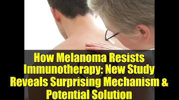 How Melanoma Resists Immunotherapy: New Study Reveals Surprising Mechanism & Potential Solution