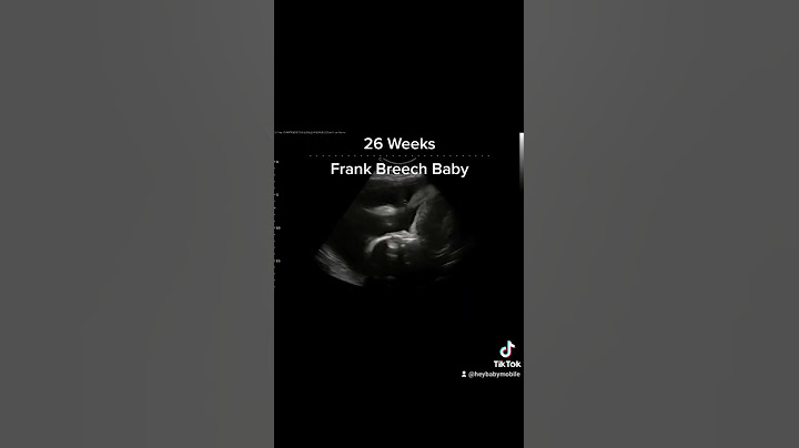 Frank Breech Baby on Ultrasound at 26 Weeks Pregnant