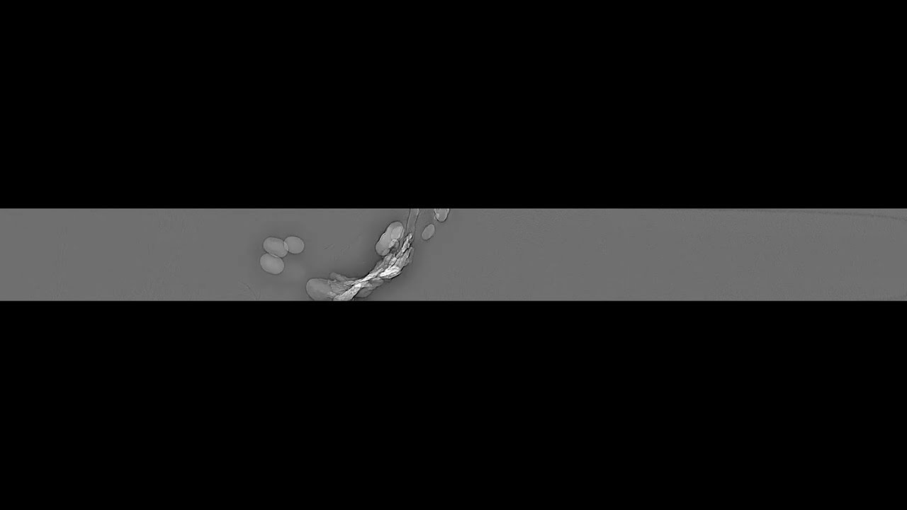 High-energy X-ray-induced bubble formation