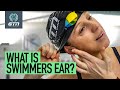 How To Treat &amp; Prevent An Ear Infection From Swimming