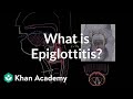 What is epiglottitis? | Respiratory system diseases | NCLEX-RN | Khan Academy