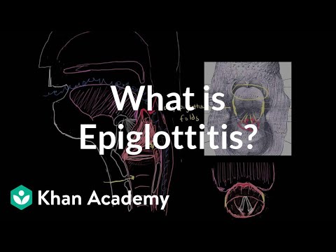 What is epiglottitis? | Respiratory system diseases | NCLEX-RN | Khan Academy