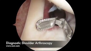 Basic Shoulder Arthroscopy