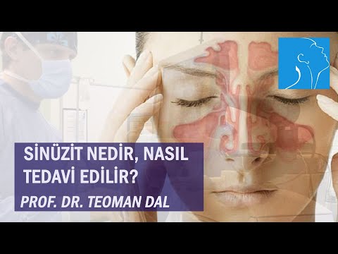 Video: Sinüs Ağrısı Nasıl Kolaylaştırılır: 14 Adım (Resimlerle)