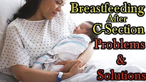 Breastfeeding After a C-Section. Problems and Solu...