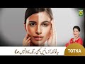 Zubaida apa totkay  beauty tips for sun burn skin  sunburn causes  treatment  masalatv