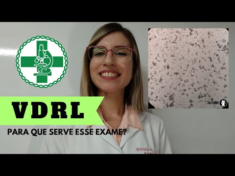 Vídeo: Teste VDRL: Objetivo, Procedimento E Resultados