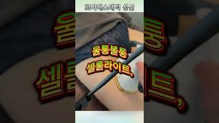 다리 부종 코끼리 다리 이쁜 다리로 만드는 비법서 #다리부종 #다리붓기 #날씬
