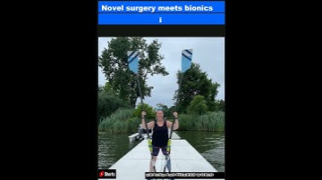 Novel surgery meets bionics in breakthrough for limb amputation|Shorts