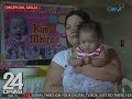 24 Oras: Baby miracle na sobrang liit nang isilang, masigla at patuloy na lumalaban