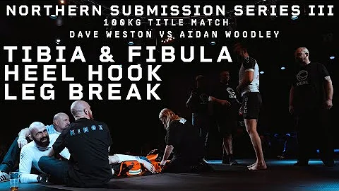 TIBIA & FIBULA LEG BREAK | BLACK BELT KILLER AIDAN...