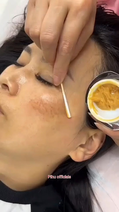 Hilangkan Flek Hitam & Pigmentasi Secara Alami di Rumah | Dapatkan Kulit Bercahaya #kulit #cantik #celana pendek