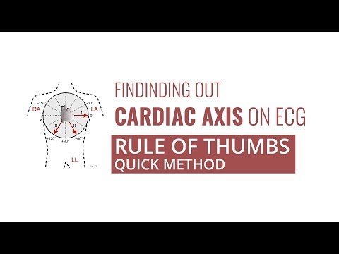 ekg-cardiac-axis-|-rule-of-thumbs