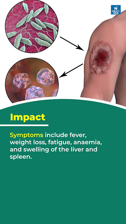 India: Target to eliminate Kala-Azar by 2023 | Black Fever | Current Update | UPSC