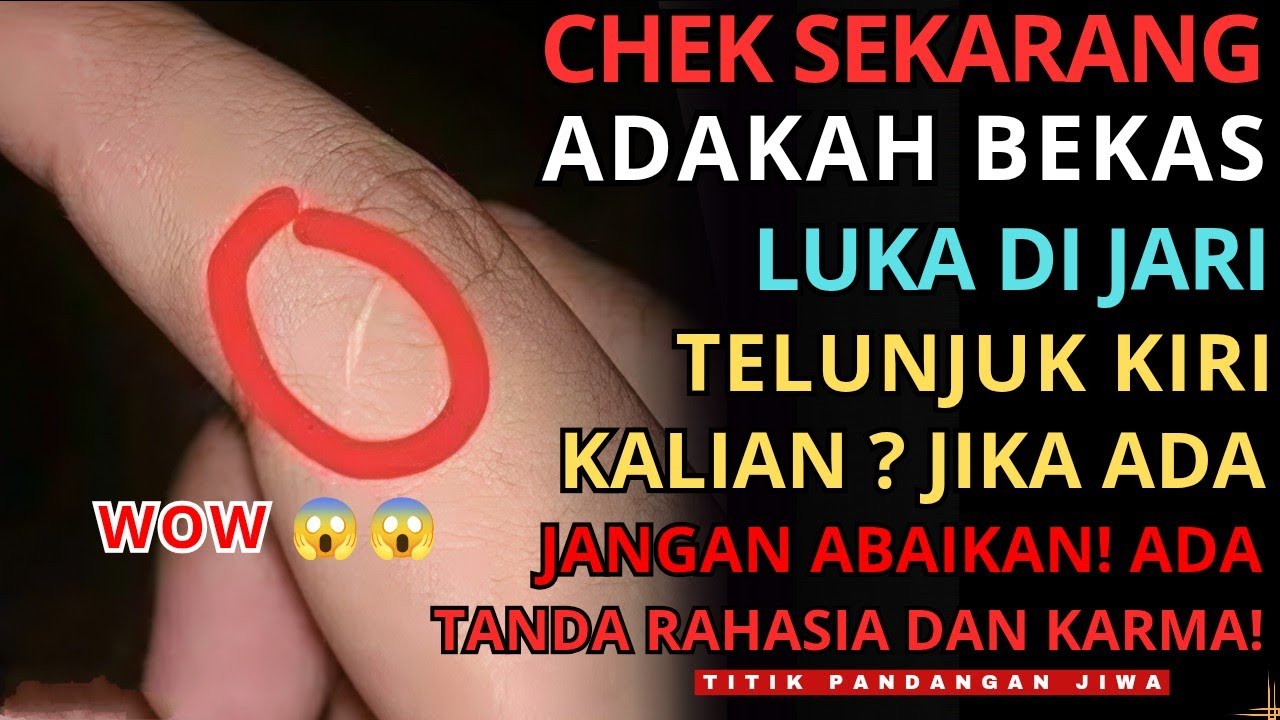 Jiwa Terpilih💫 VIRAL! Inilah Makna dari Bekas Luka Di Jari TELUNJUK Bagian Kiri! Jangan abaikan!😱😱🚀