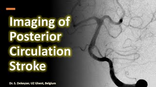 Imaging of Posterior Circulation Stroke - Basilar artery thrombosis and beyond (improved sound)