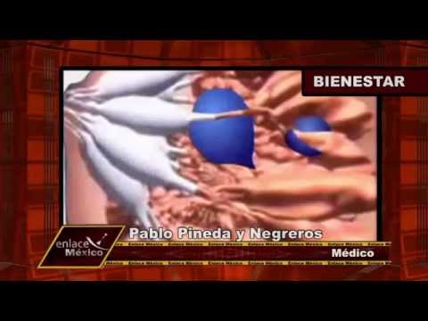 que es mastopatia fibroquistica birads 2
