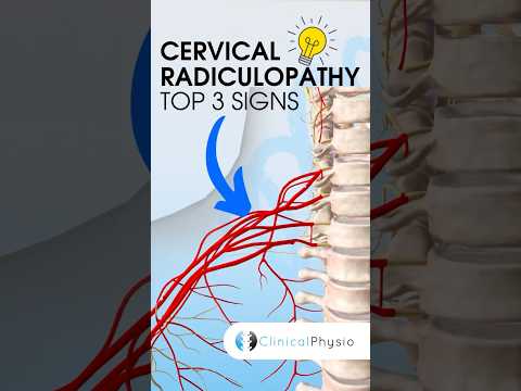 Video: Radiculopathy - what is it and how it is manifested, causes, cervical and lumbar radiculopathy, diagnosis, treatment