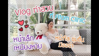 Beauty Vlog: สวยทันใจ หน้าเรียว เหนียงหาย ด้วย hi-fu +รีวิวทรีตเมนท์ผลักวิตามินเพื่อผิวสวยใส มีออร่า