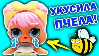 КУКЛЫ ЛОЛ видео ПИКНИК! Дон укусила ПЧЕЛА! Все куклы ЛОЛ СЮРПРИЗ Мультики LOL SURPRISE |Julicat (0+)