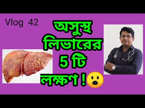 ক্ষতিগ্রস্ত  লিভারের  5 টি  লক্ষণ | Symptoms of liver damage|Liver damage |লিভারের  সমস্যা