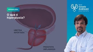 O que é hiperplasia da Próstata? | Dr. Cássio Andreoni CRM 78.546