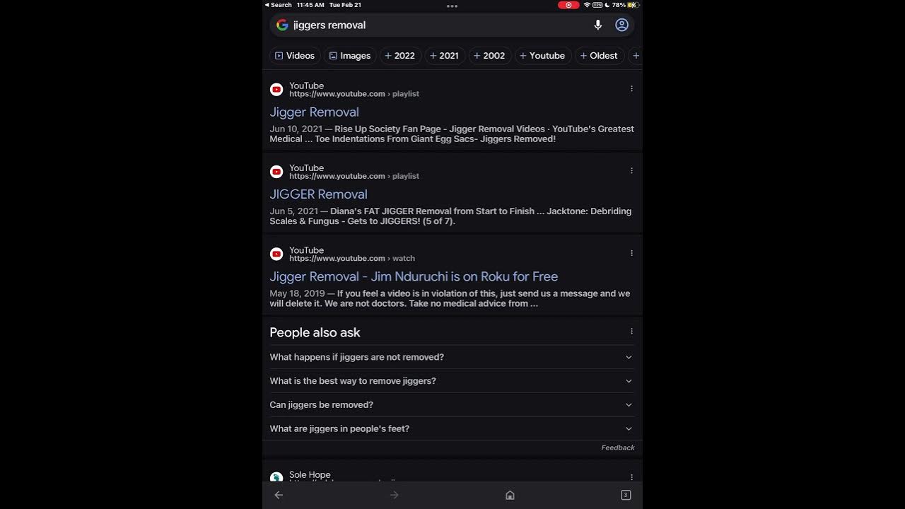 Don't search jiggers removal on google ( ε ) YouTube
