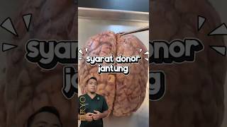 Ini dia syarat donor jantung, ngga semua orang bisa #dryo