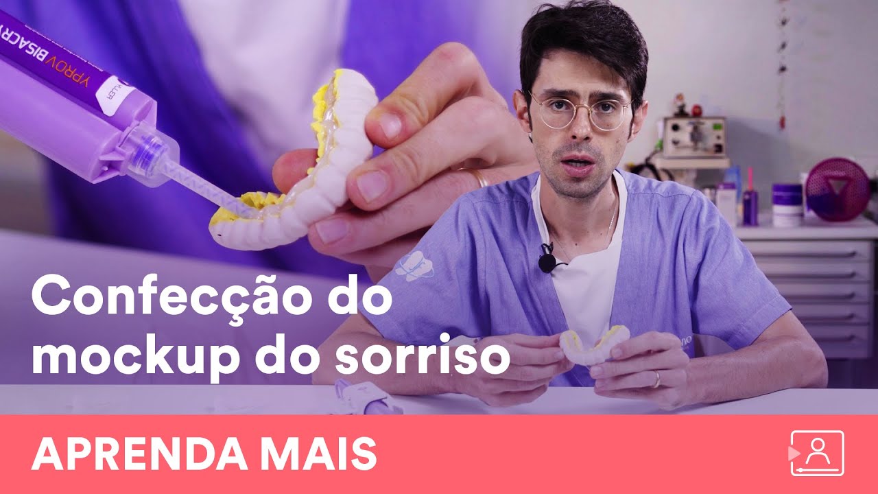 Restaurações com o MOCKUP do sorriso!