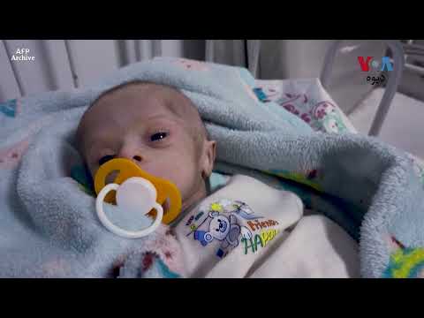 متحده قامونه په افغانستان کې روانه خوارځواکي د زرګونو ماشومانو ژوند په خطر کې اچولی شي