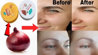 एक प्याज से अपनी उम्र 20 साल कम दिखोगे\\Home made anti wrinkles cream\\make anti ageing onion cream