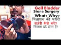 Gall bladder surgery process