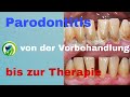 Parodontitisbehandlung -Ablauf Zahnfleischbehandlung Vorbehandlung | Zahnfleisch Therapie | PZR