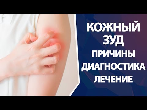 Кожный Зуд: Причины, Диагностика, Лечение